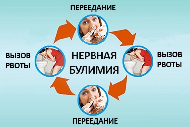 Лечение булимии в Гулькевичи